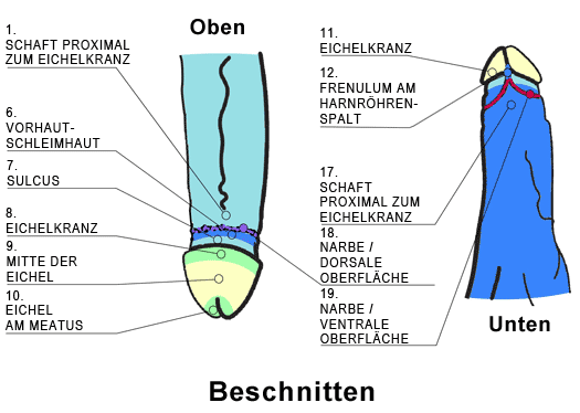 Beschnitten nicht beschnitten und Beschnitten? Unzufrieden?