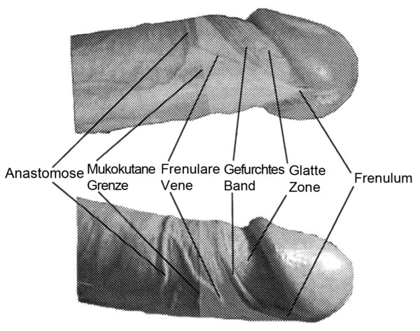 Am glied bändchen Riss des