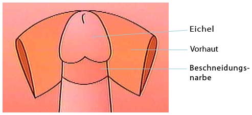 Beschneidung: Vorhaut (eine Doppelfalte aus spezialisiertem. 