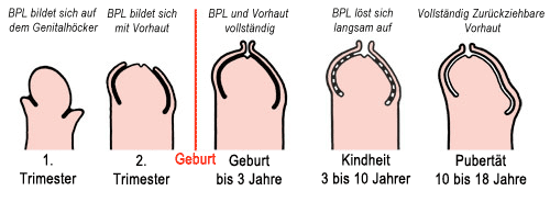 Selbst kürzen vorhaut Sich beschneiden