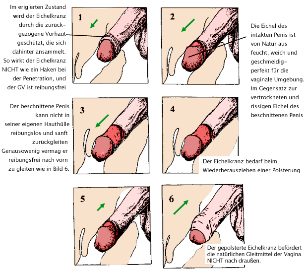 Zustand penis im schlaffen Penis des