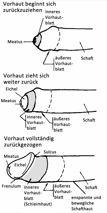 Oder zurück vor vorhaut Einfluss der