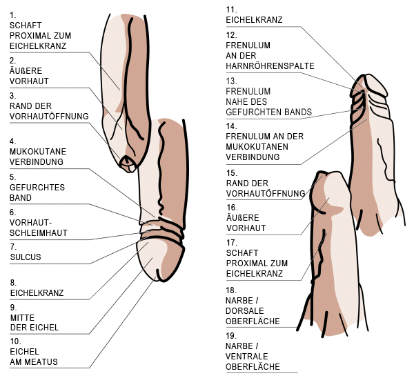 Beschnittenen penis